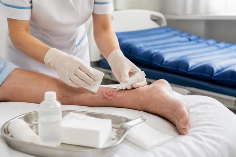 découvrez nos conseils pratiques pour prévenir et soigner efficacement une escarre sur la jambe, afin d'améliorer le confort et favoriser une guérison rapide.