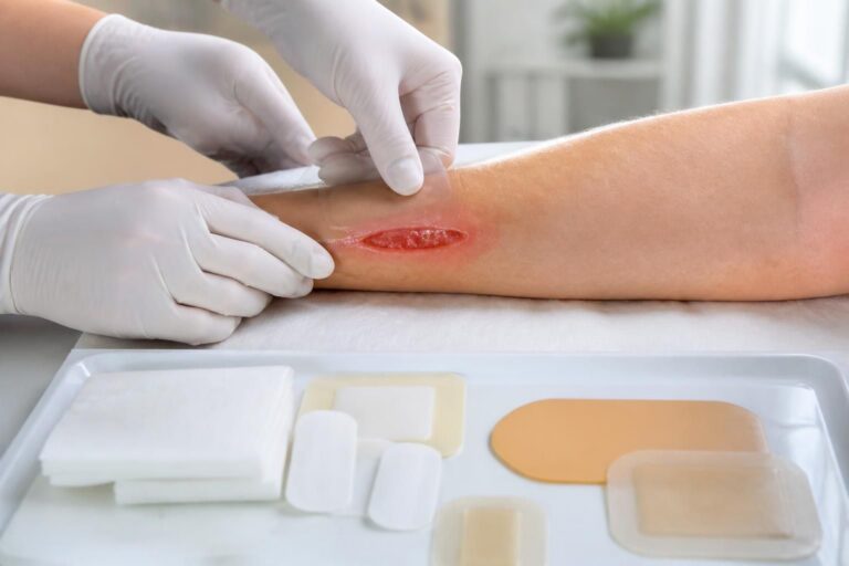 découvrez comment bien choisir et appliquer un pansement cicatrisant pour plaies ouvertes afin d'optimiser la guérison et prévenir les infections.